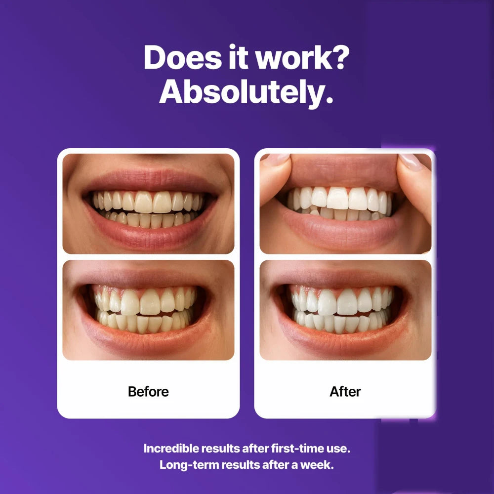 Purple Tooth Strips Gently Clean Teeth And Tartar, Care For And Brighten Teeth, Are Portable And Easy To Use For Daily Care